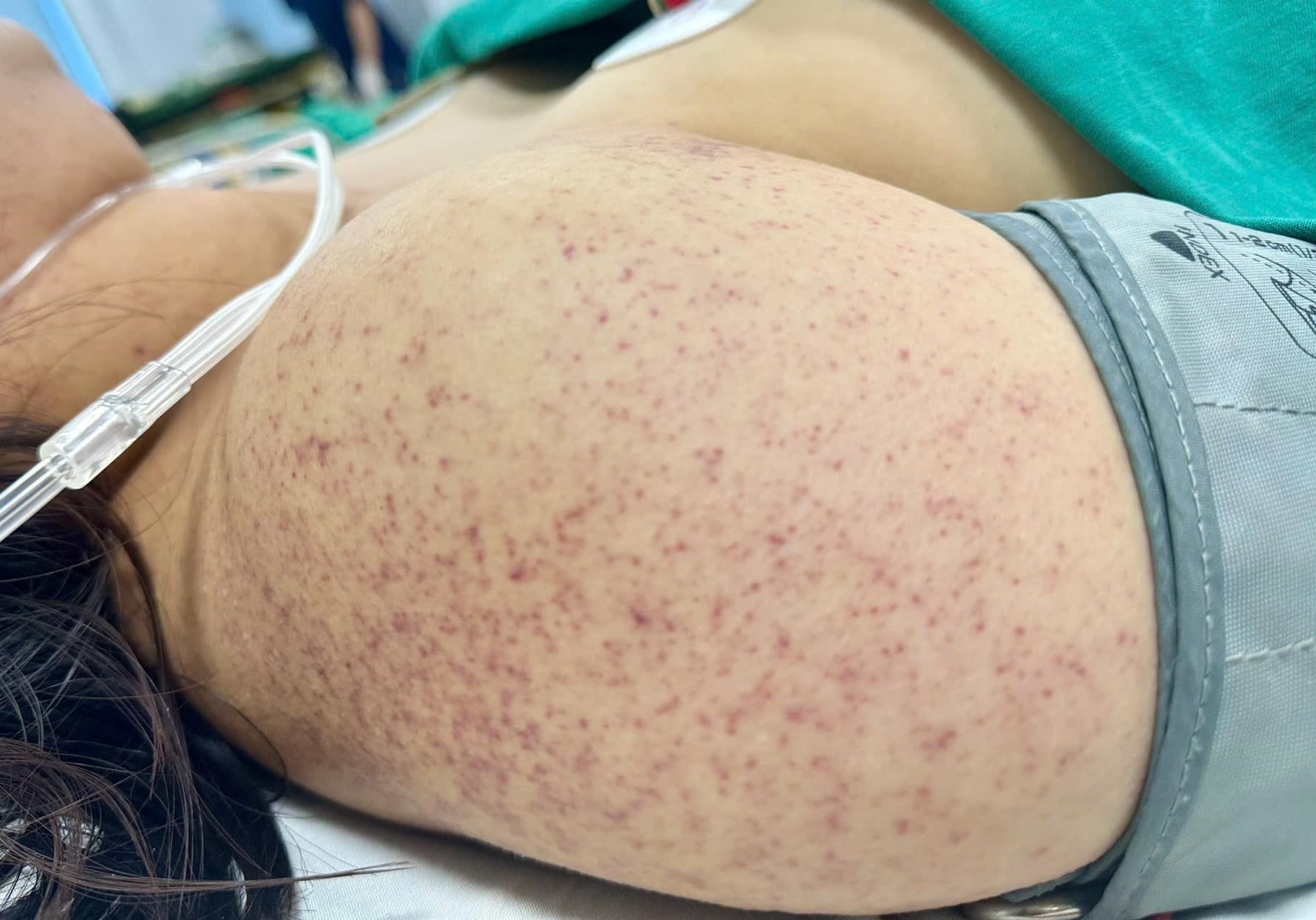 Cang thang ca do sinh cho thai phu sot xuat huyet bat ngo chuyen da hinh anh