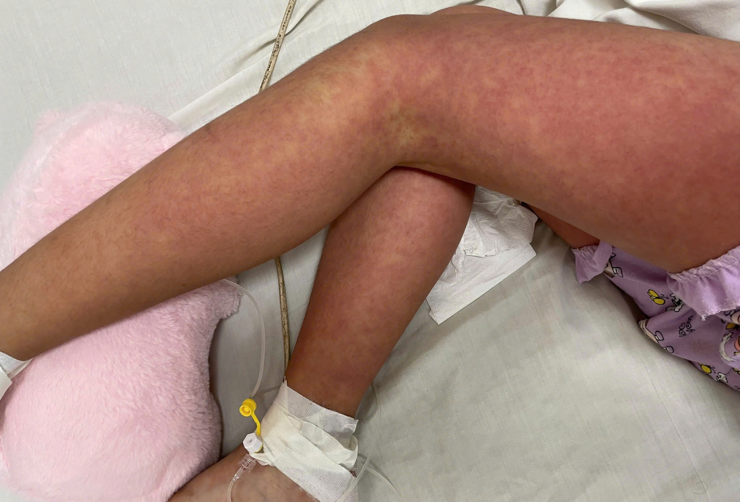 Be gai noi ban toan than, khong ngo mac benh hiem hinh anh