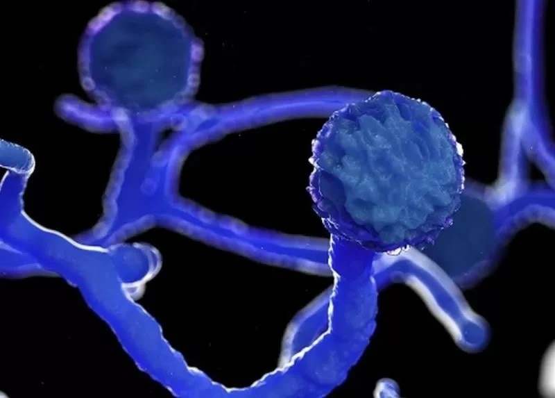 Di kham suot 3 thang khong ra benh vi mac loai nam nguy hiem hinh anh