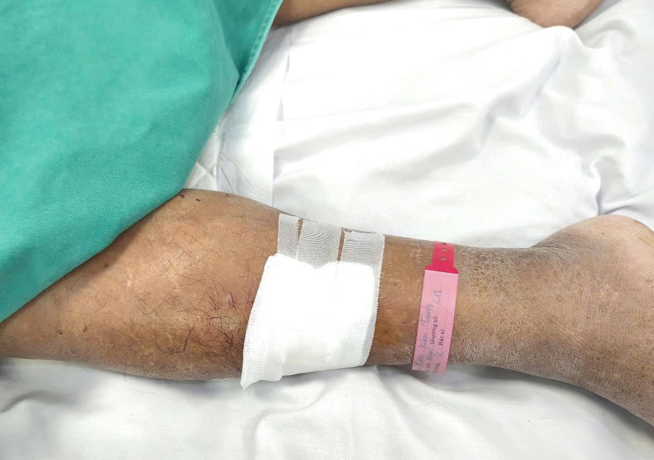 Tai nan nho tren duong khien nguoi dan ong nguy kich hinh anh