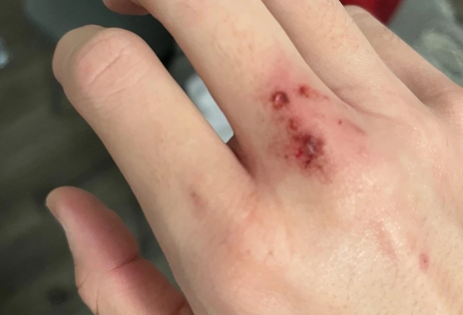 Nguoi dan ong mat mang vi vet cao cua meo hinh anh