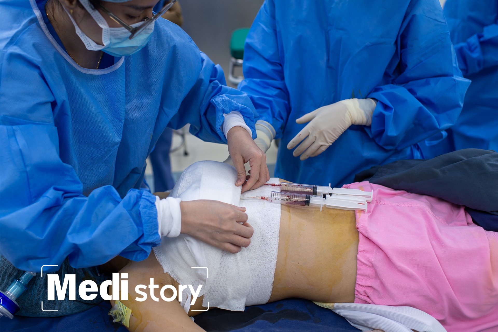 Can canh quy trinh phau thuat tao hinh vong mot hinh anh