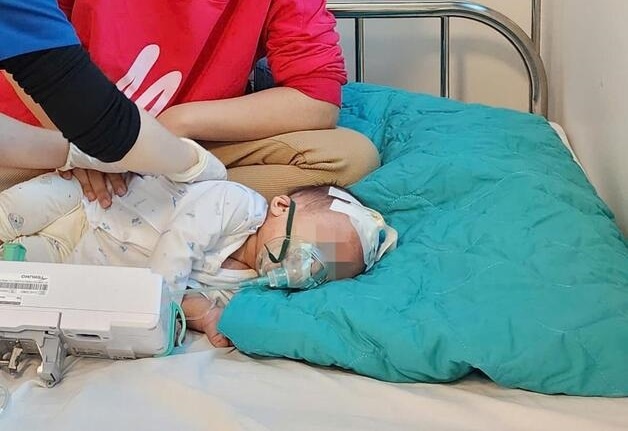 Chuyen gia ly giai ly do so ca mac soi o Ha Noi tiep tuc tang hinh anh