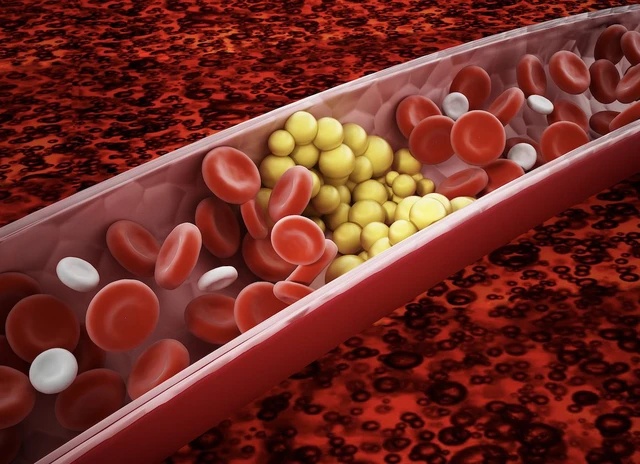 5 ly do khien mo mau tang cao khi thoi tiet lanh hinh anh