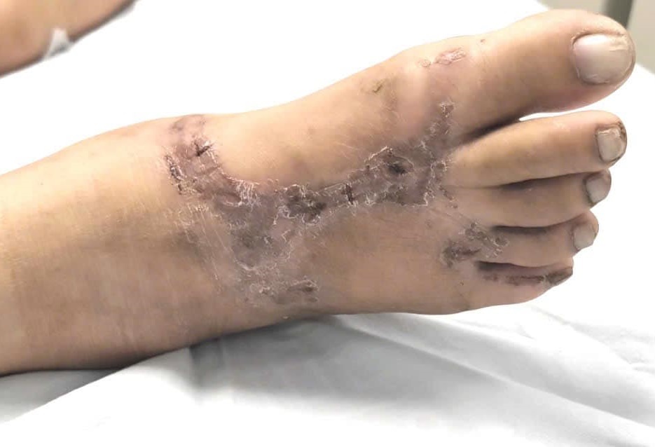 Thoi quen hang ngay khien nguoi phu nu doi mat benh nguy hiem hinh anh