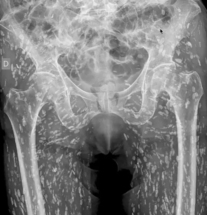 thoi quen an thit lon anh 1