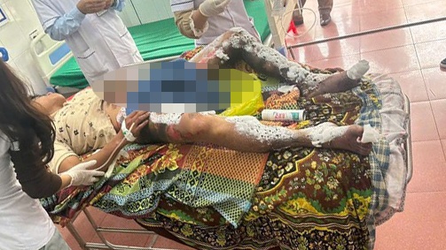 Dien thoai trong tui quan phat no, thanh nien bong nang vung kin hinh anh