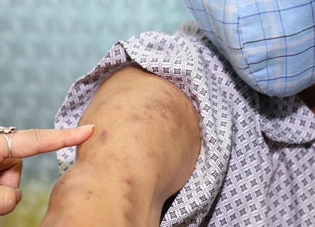 Dau nhu dien giat, nguoi dan ong bat ngo khi biet ly do hinh anh