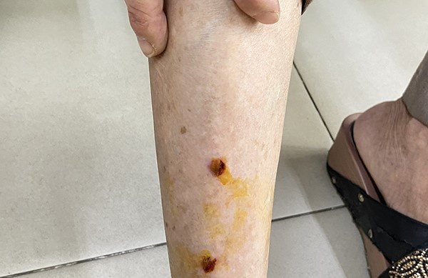 Sai lam khien nhieu nguoi mat mang vi benh dai hinh anh