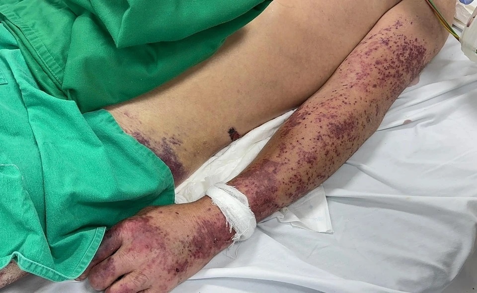 Mot nguoi dan ong o Ha Noi mac lien cau lon hinh anh