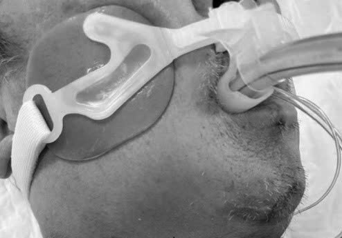 Sai lam khi tu chua dau rang khien nguoi dan ong suy da tang hinh anh