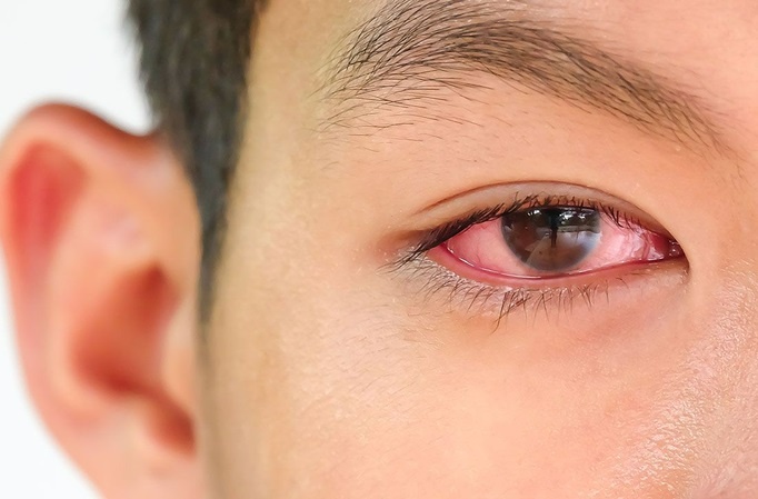 Dau hieu chung to ban dang bi dau mat do hinh anh