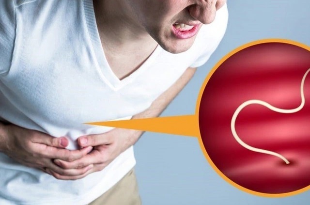 Nguyen nhan, bieu hien, cach dieu tri va phong benh giun toc hinh anh