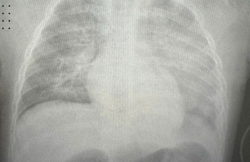 Phoi trang xoa chi sau 6 gio ho, sot hinh anh