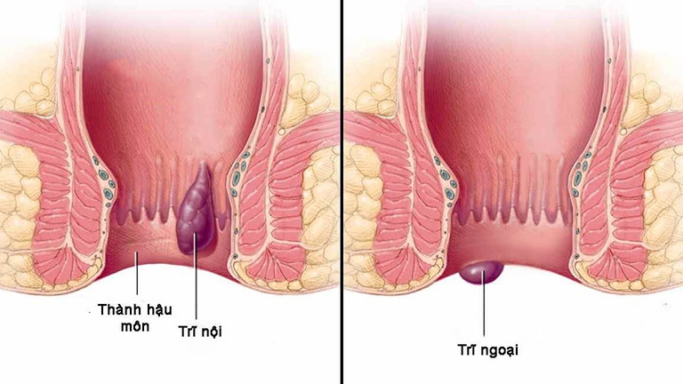 benh tri anh 1