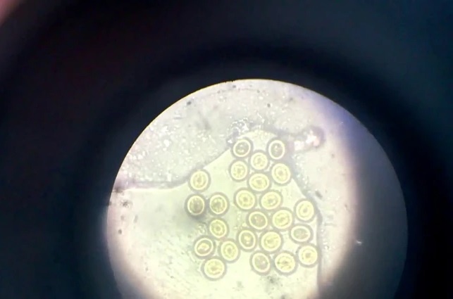 Cach an uong 'ruoc' san vao nguoi nhieu nguoi khong de y hinh anh