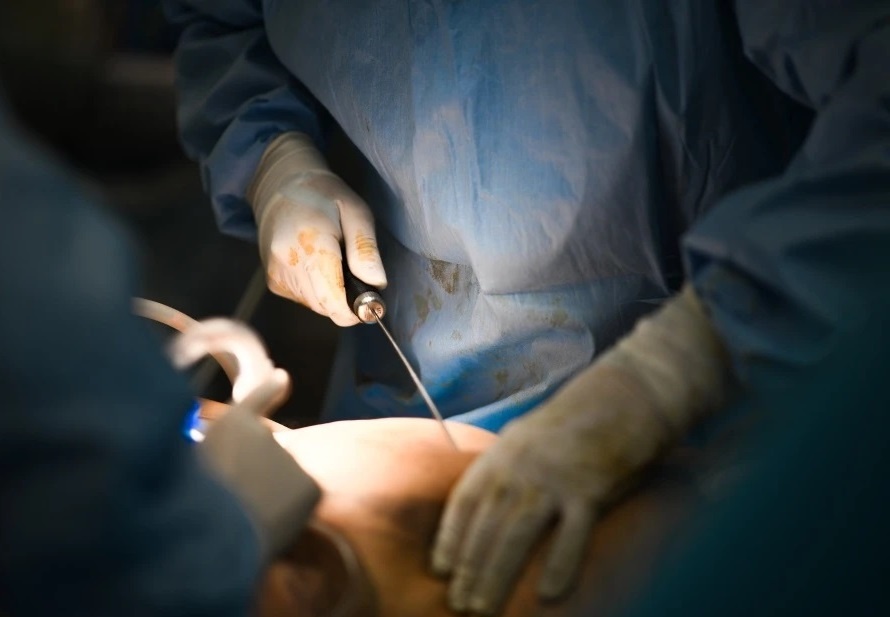 Tai bien tham my tai Benh vien Da khoa Gia Dinh hinh anh