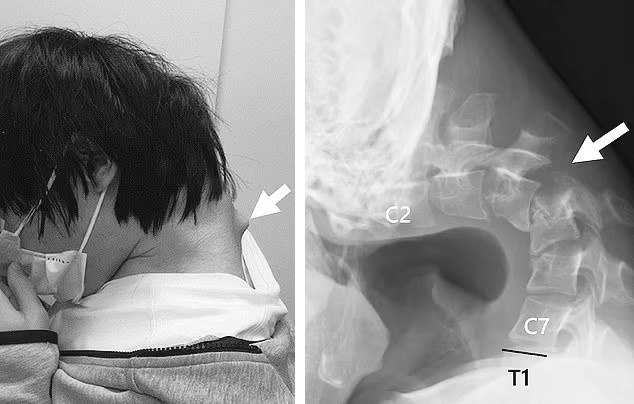 Hinh anh co veo vo dang so cua nam thanh nien vi so thich quen thuoc hinh anh