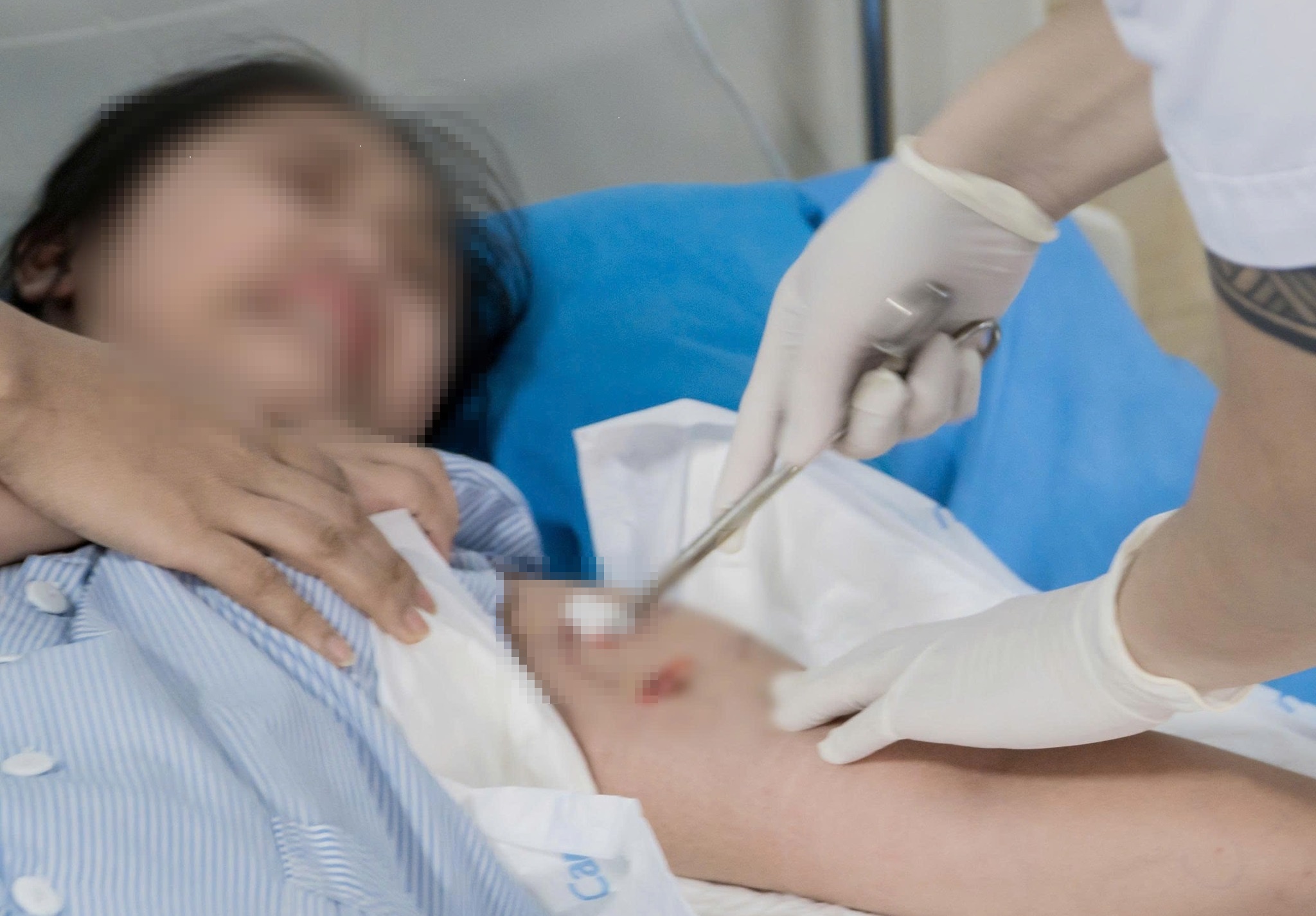 Be 12 tuoi bi cho nha hang xom can nhieu vet tren co the hinh anh