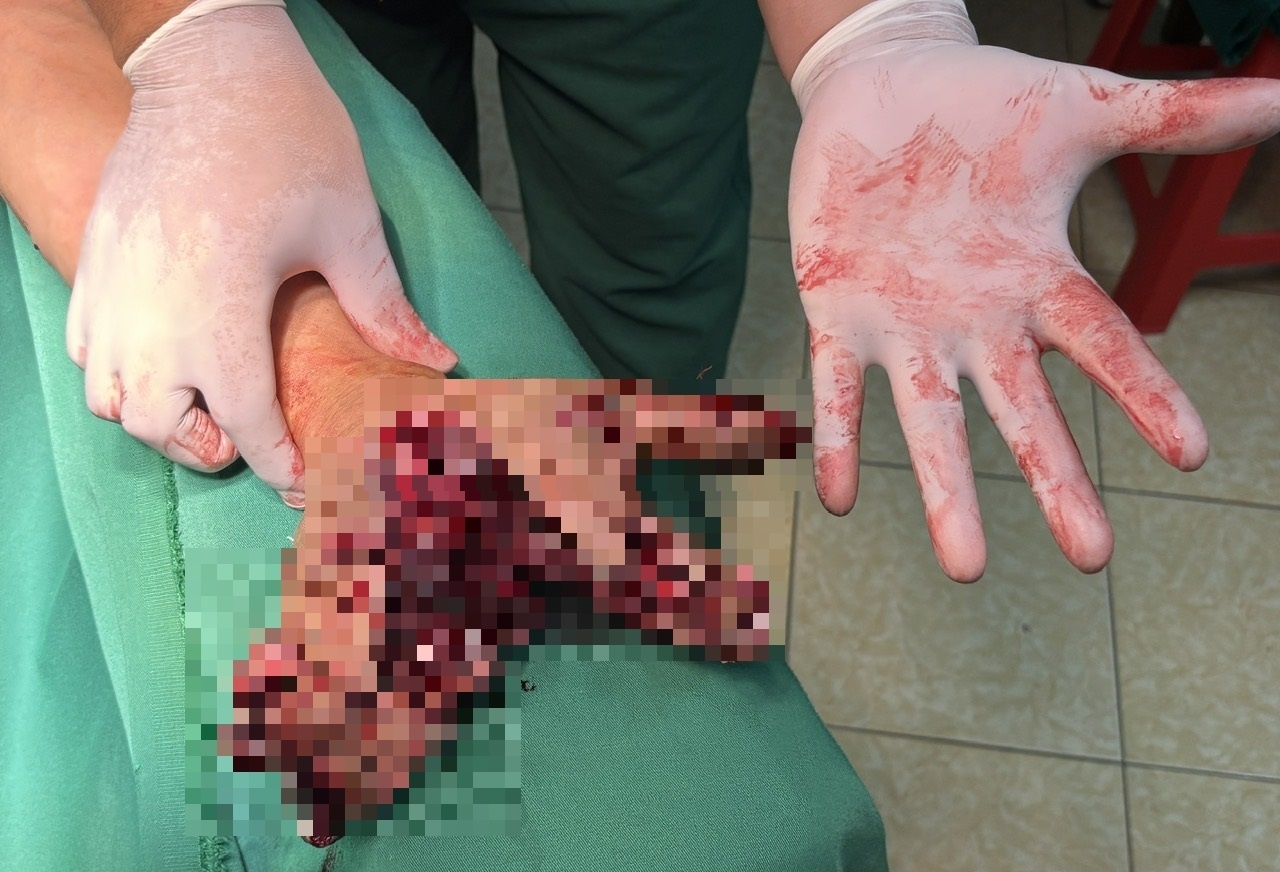 Dung dien thoai khi dang sac, nguoi dan ong bi che doi ban tay hinh anh