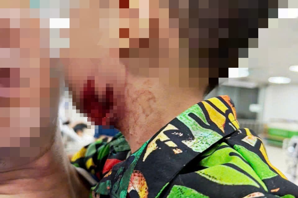 Be 2 tuoi bi cho tan cong, rach co sat mach canh hinh anh