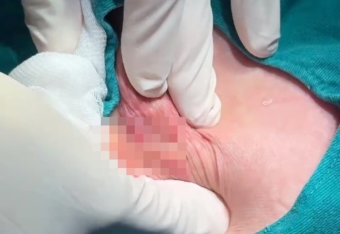 Bo gan tram trieu nang mong, 2 phu nu nhan 'ket dang' hinh anh