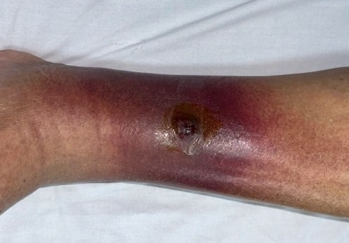 Moi nguy tu nhung vet tray nho hinh anh