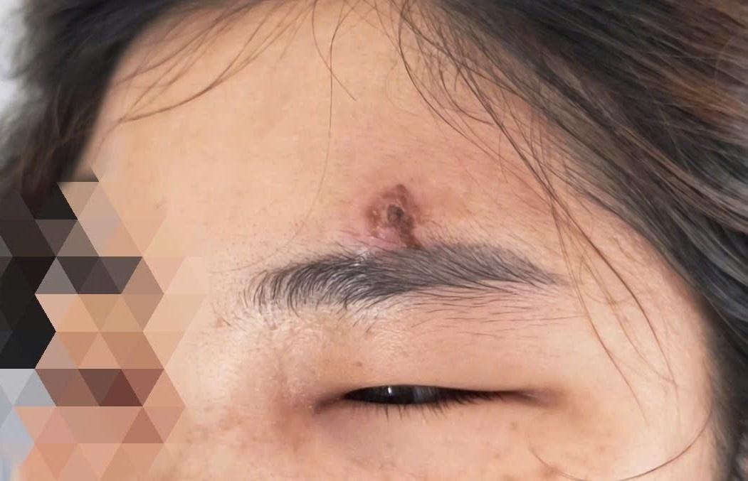 Tu nan mun, nguoi phu nu o Ha Noi bat ngo roi vao nguy kich hinh anh