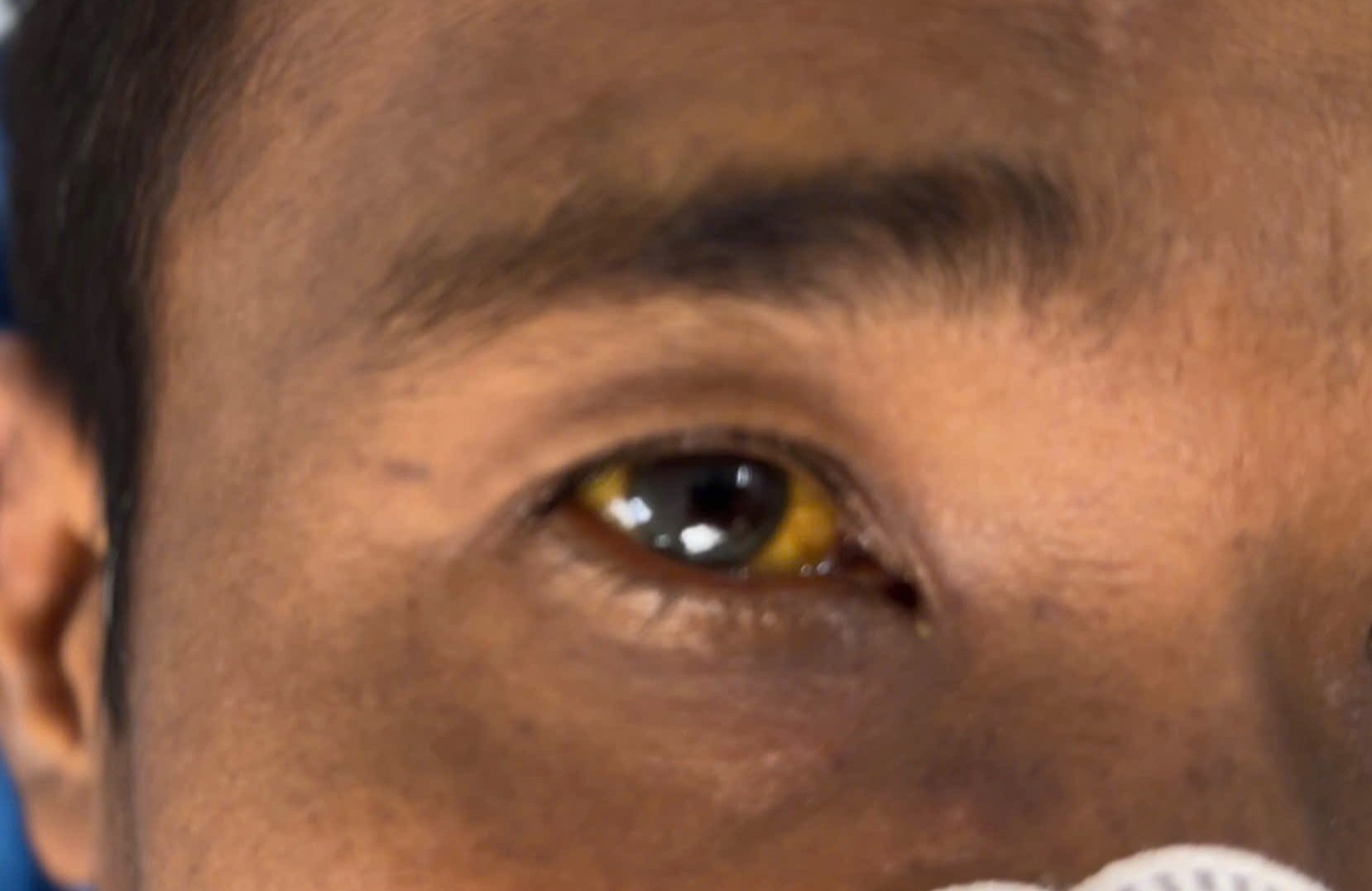 Gan ton thuong nang chi vi mot quyet dinh sai lam hinh anh