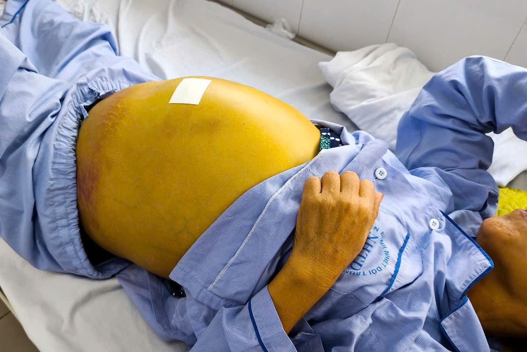 Ban co chac gan minh dang khoe manh? hinh anh