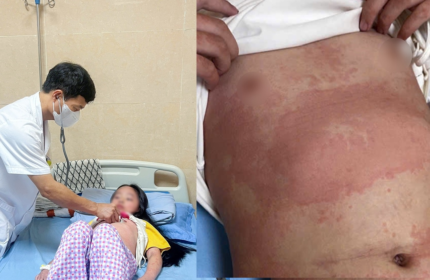 Be gai 8 tuoi nhap vien luc nua dem vi ban nhiem khuan hinh anh