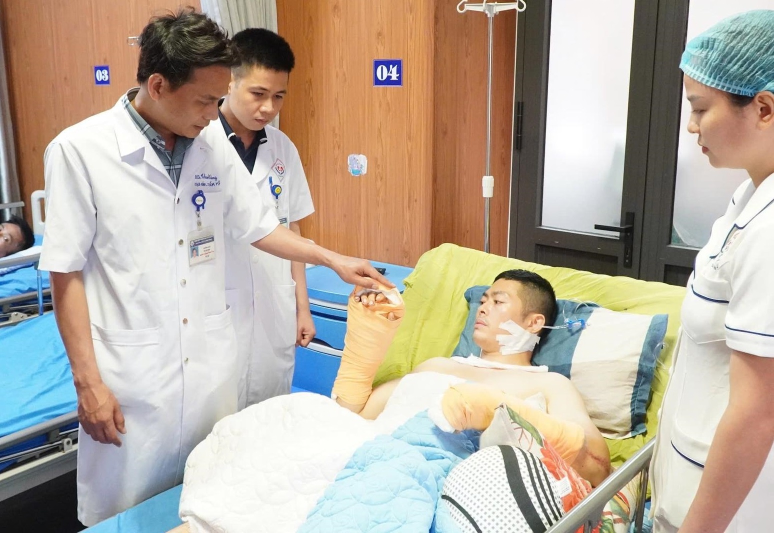 Doi tay bi chem dut roi cua TikToker Ha List hien ra sao? hinh anh