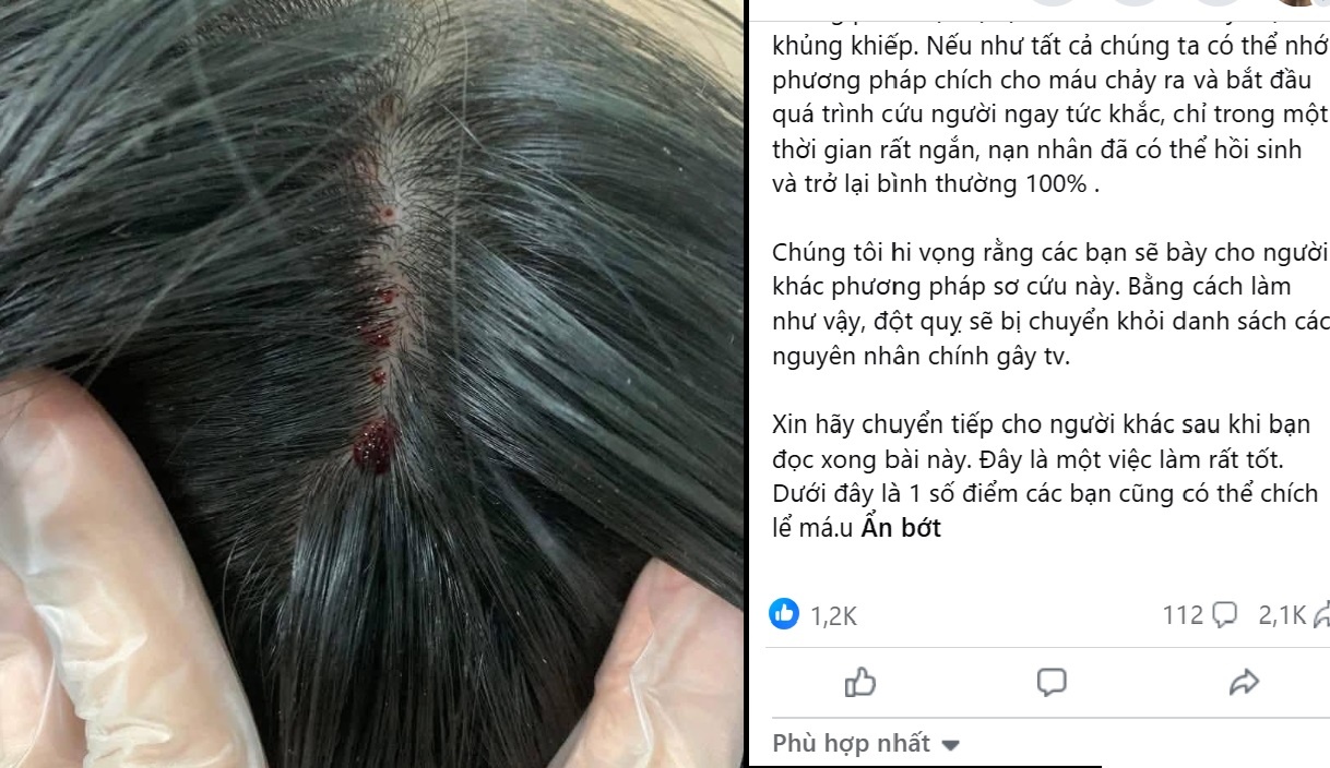 chua dot quy anh 1