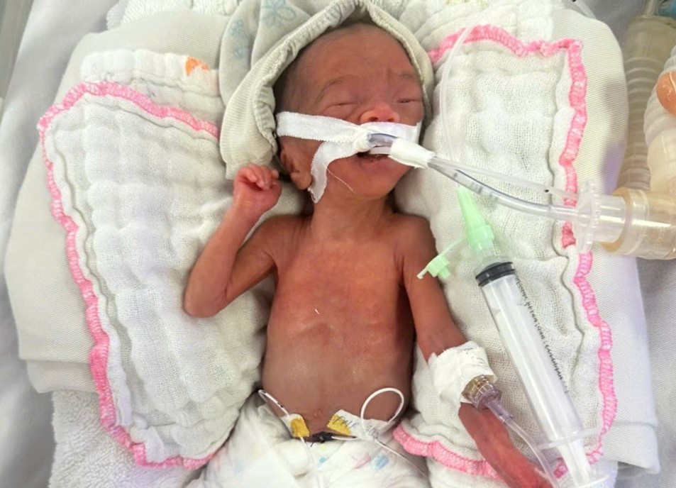 Be gai chao doi chi nang 550 gram, gio ra sao? hinh anh