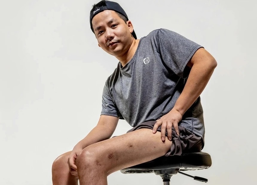 Khoa Pug chi 3 ty keo chan lan 2: Bac si noi gi? hinh anh