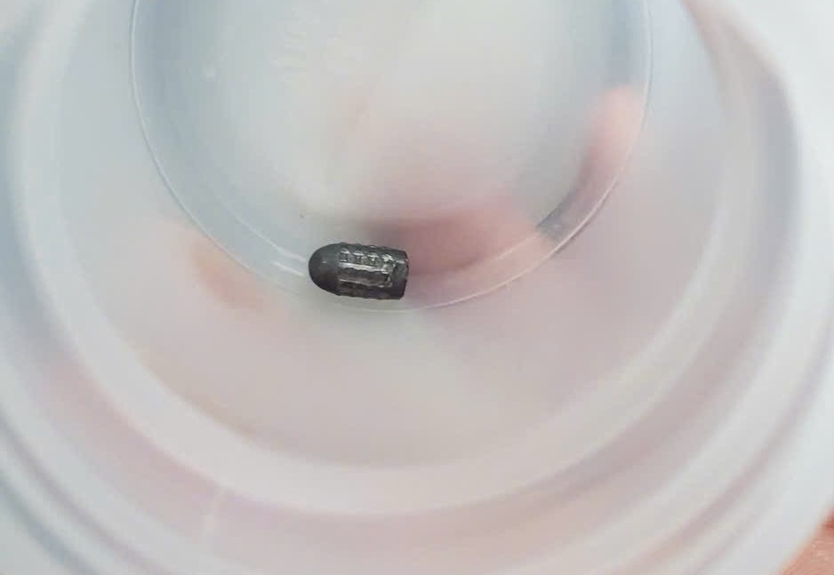 Nguoi phu nu bi vat la gam vao dau, nghi dan lac hinh anh