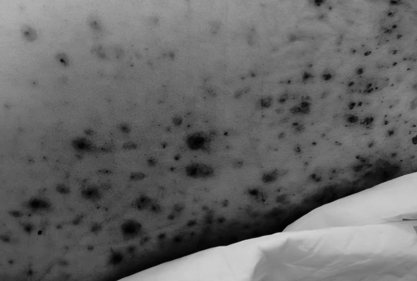 Thanh nien 30 tuoi nguy kich vi thuy dau, benh tuong chi gap o tre hinh anh