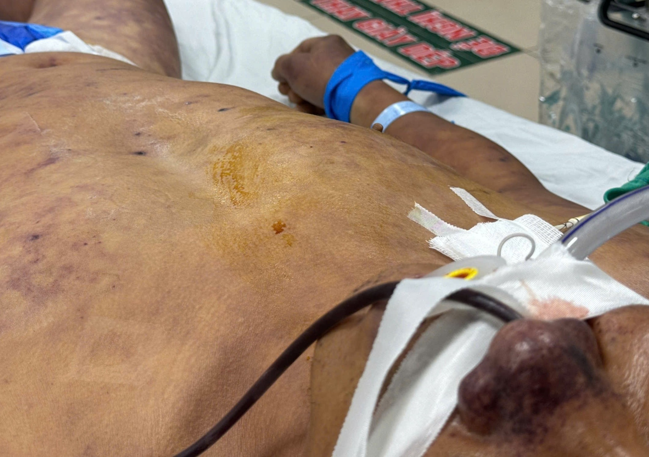 'Tu than' rinh rap tu mon thit quen thuoc cua nguoi Viet hinh anh