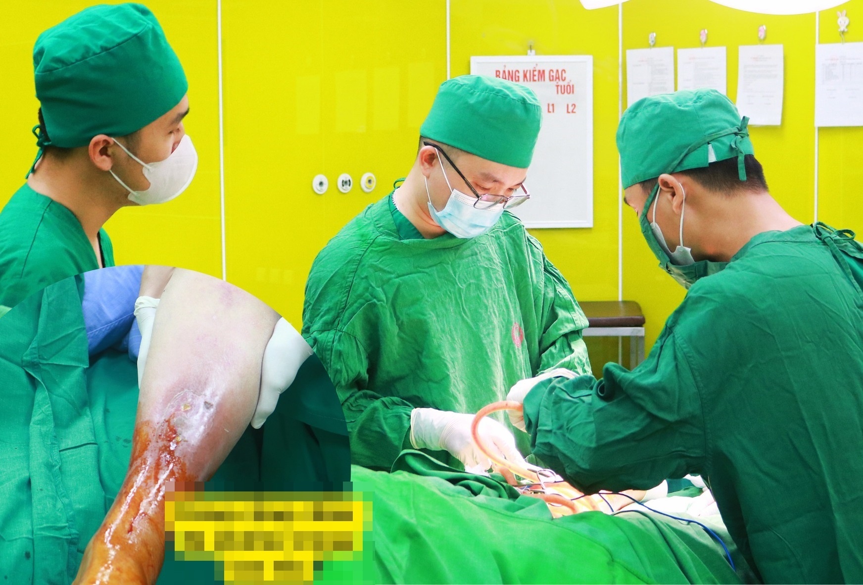 Not mun o chan day nguoi phu nu vao tinh canh nguy hiem hinh anh