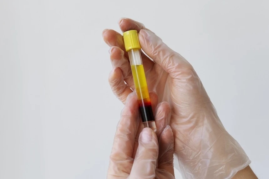 Nguoi phu nu bat ngo khi biet ly do mo mau tang don dap hinh anh