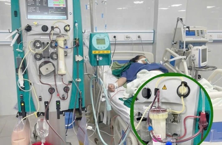 Nguoi phu nu 35 tuoi phai loc mau cap cuu ngay sau khi sinh con hinh anh