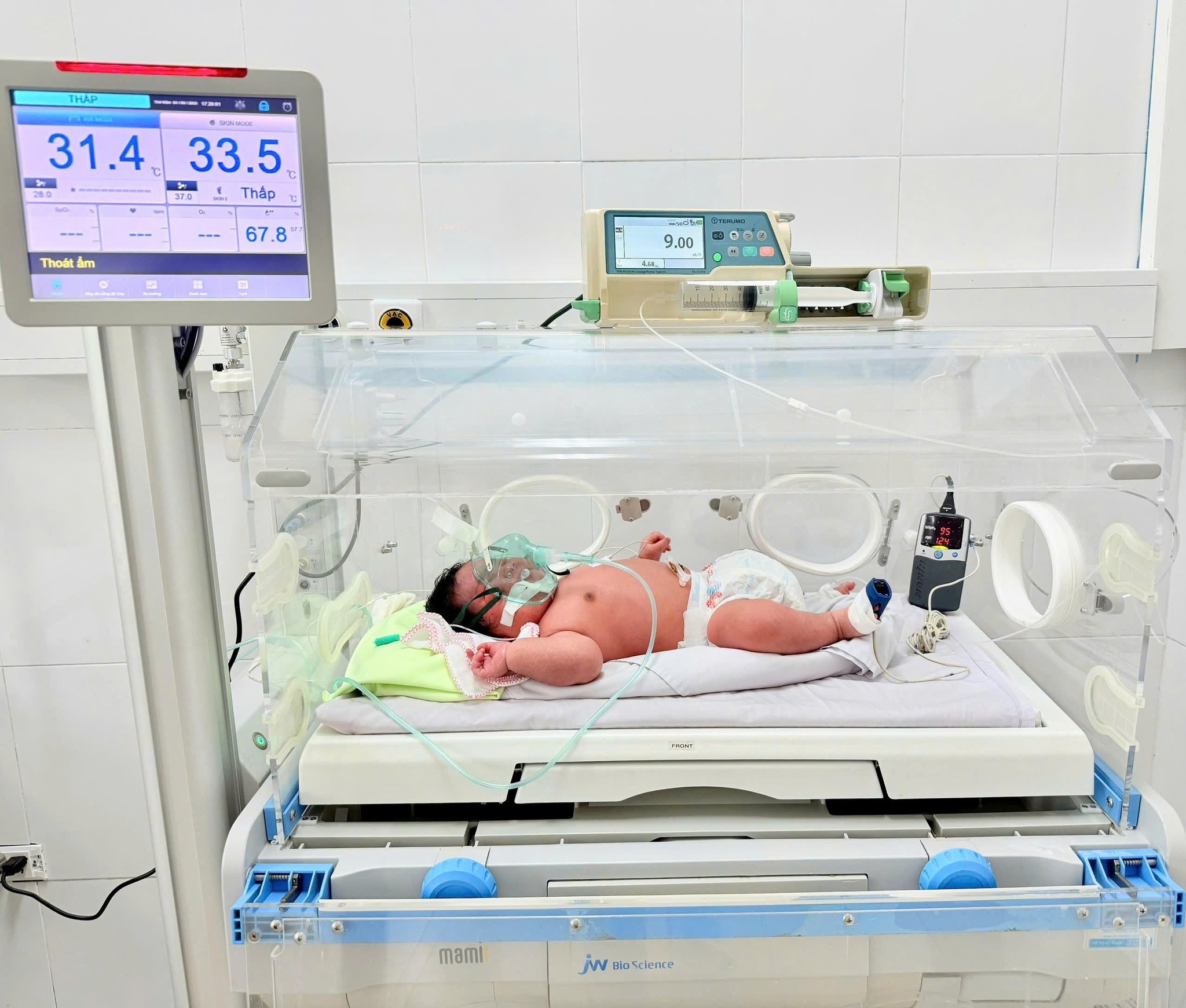 em be 6, 2 kg anh 1