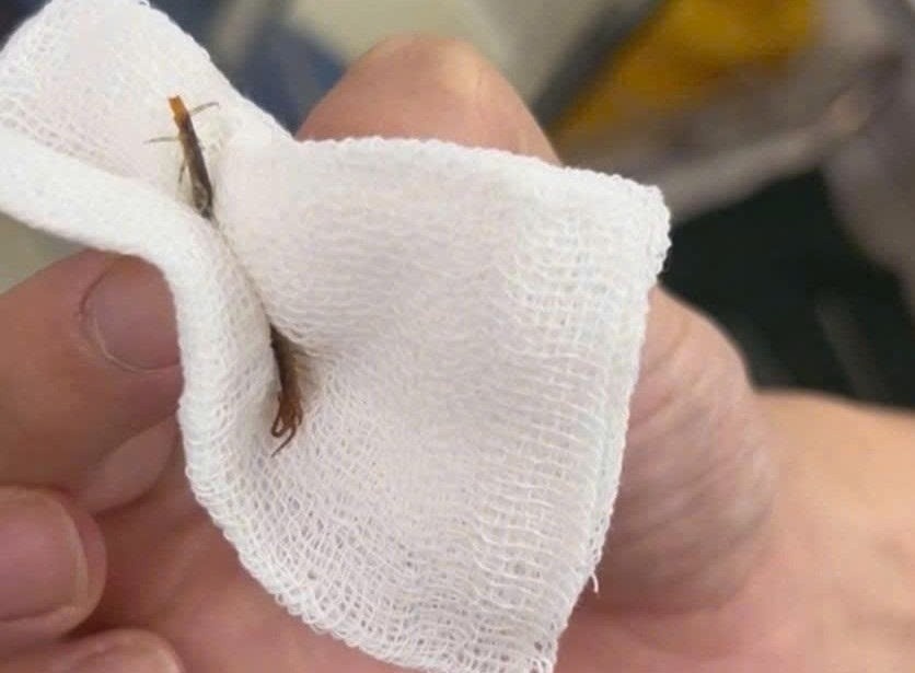 Dau tai du doi, di kham duoc bac si gap ra con ret song hinh anh