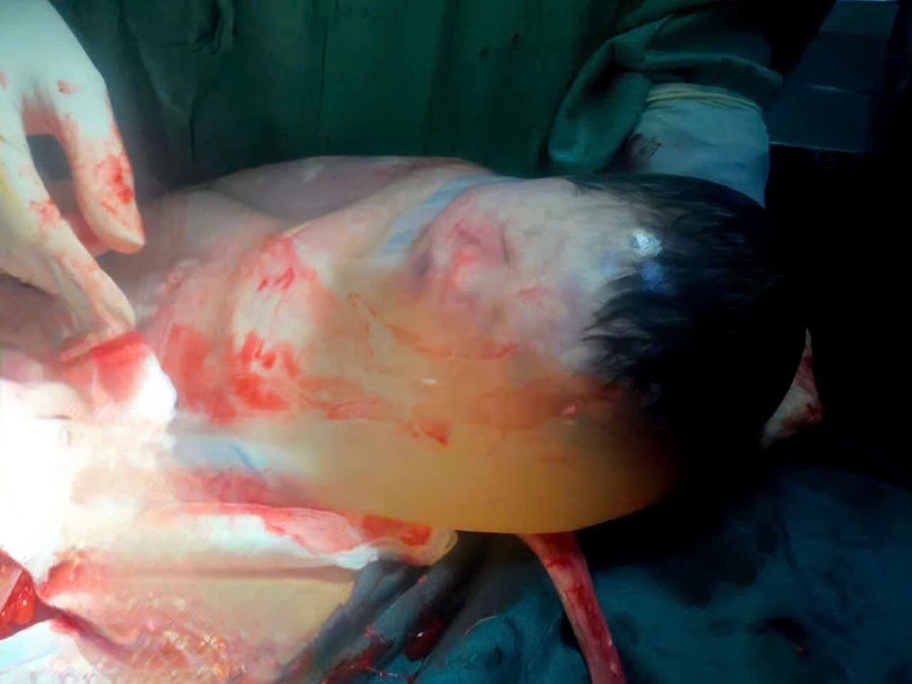 Be trai chao doi con nguyen boc dieu, bac si cung ngo ngang hinh anh