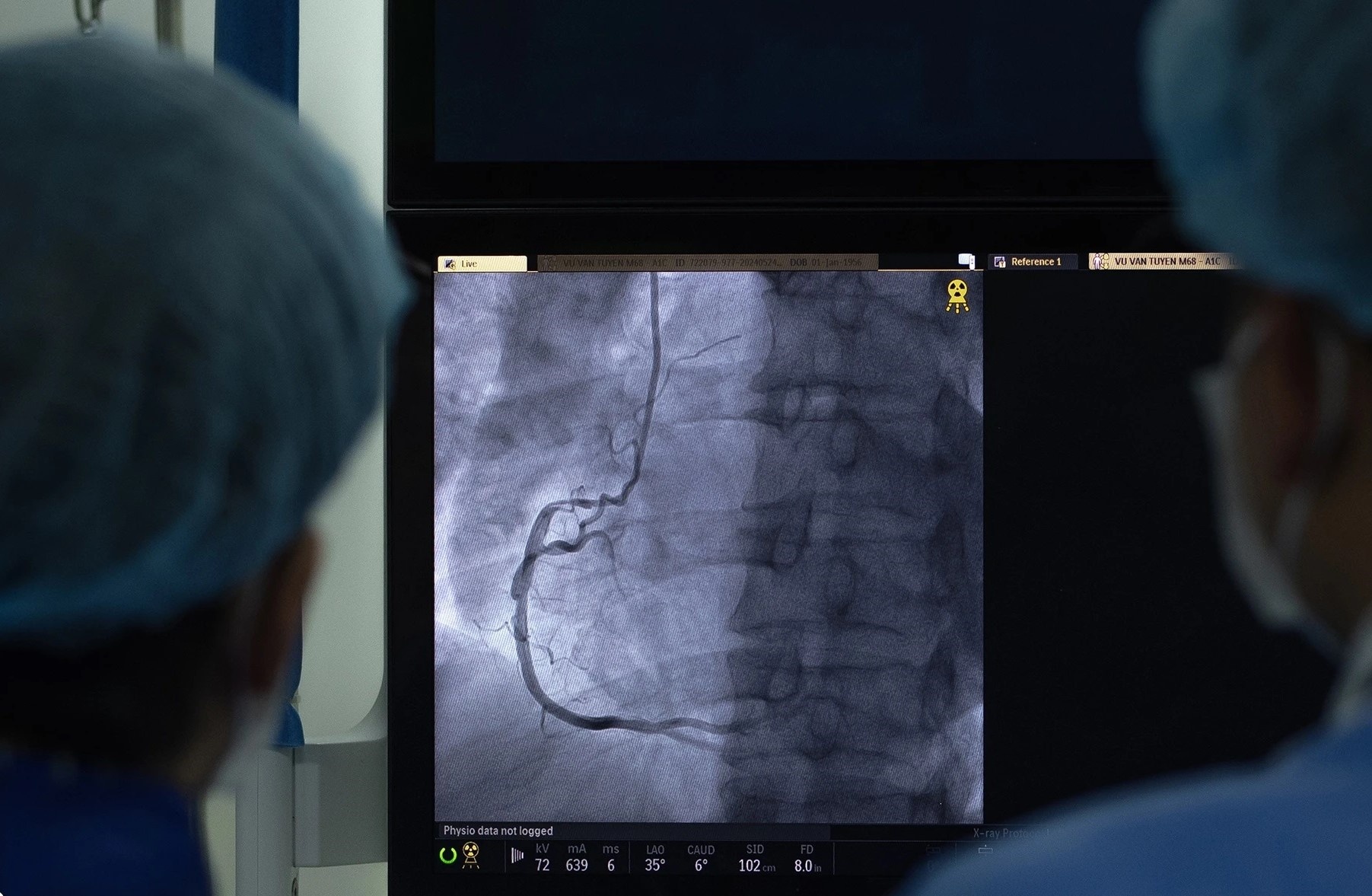 Can benh 'ha guc' gioi tre Viet, 1/4 nguoi truong thanh dang mac hinh anh