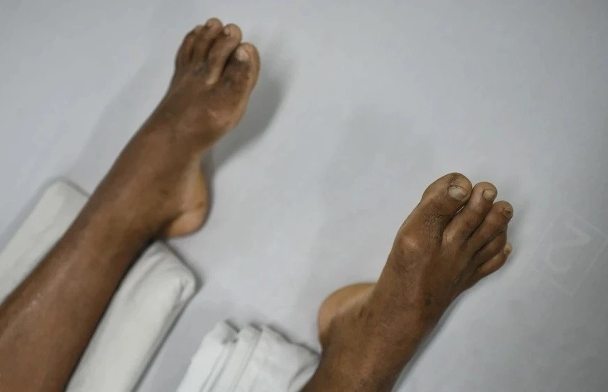 Thap tu nhat sinh chi vi chu quan voi chiec rang sau hinh anh