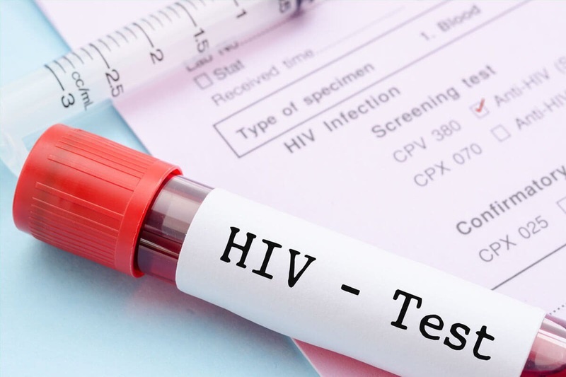 nhiem HIV anh 1