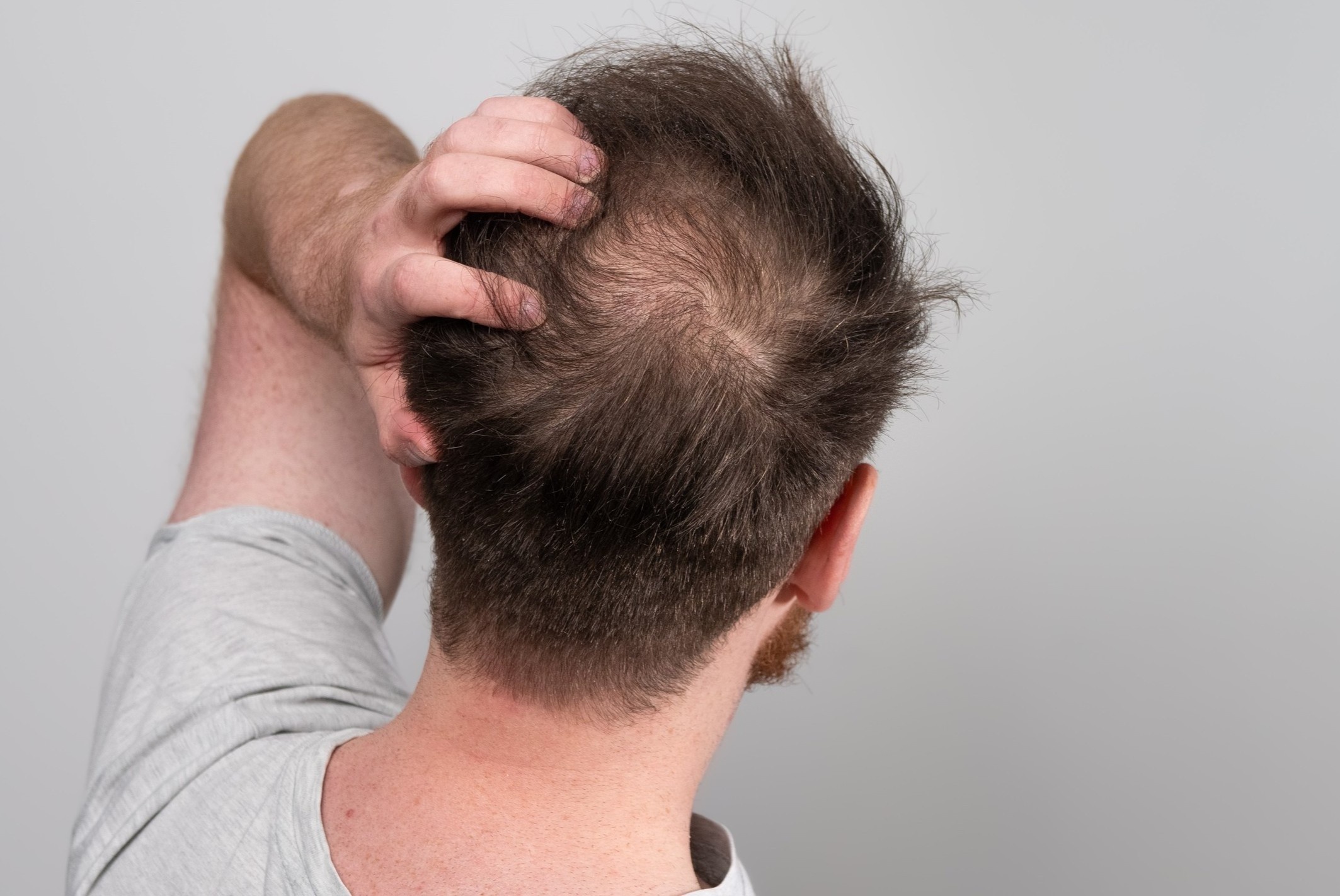 Loai do uong lam tang nguy co hoi dau o nam gioi hinh anh