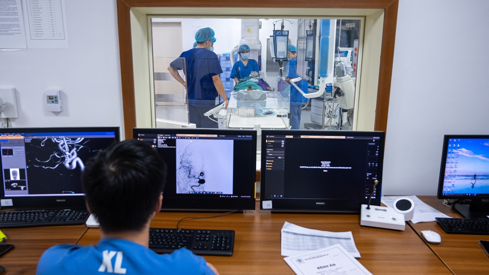 cấp cứu đột quỵ ảnh 6 cap cuu dot quy anh 6