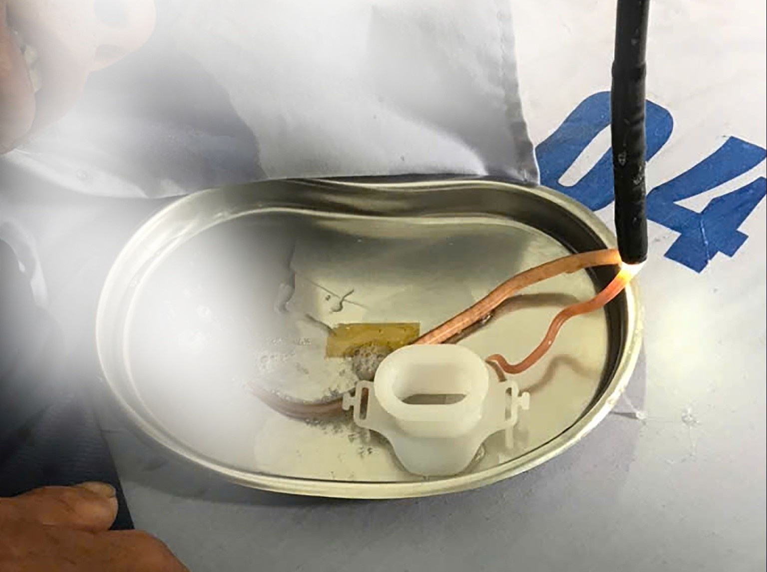 Ben trong ta trang cua nguoi dan ong 15 nam chua tay giun hinh anh